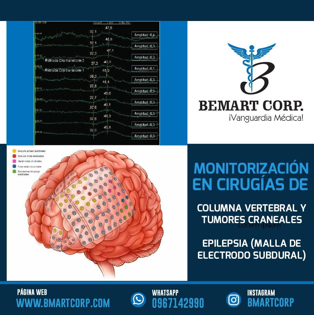 Professional Specialist In ¨Clinical Neurophysology "With Endorsement De Senescyt